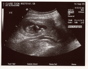 13weekUltrasound_02