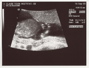 13weekUltrasound_04