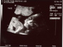 20weekUltrasound_01