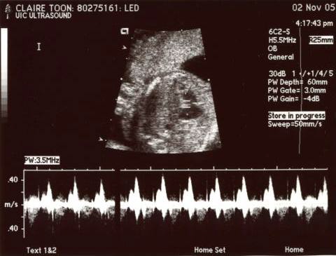 20weekUltrasound_02