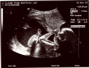 20weekUltrasound_03