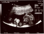 20weekUltrasound_04