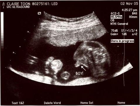 20weekUltrasound_04