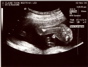 20weekUltrasound_05