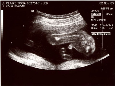 20weekUltrasound_05